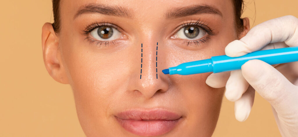 Patient consulting a specialist for rhinoplasty treatment