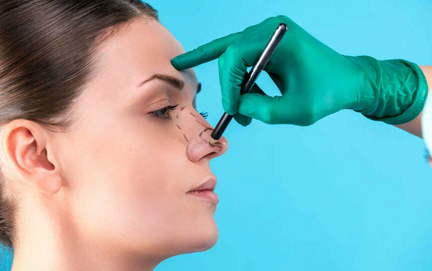 Rhinoplasty treatment for improving nose shape and facial balance