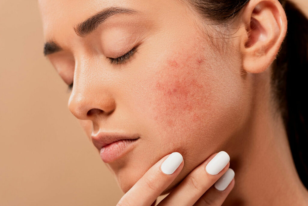Retinol serum skincare routine for smoother, brighter and healthier-looking skin